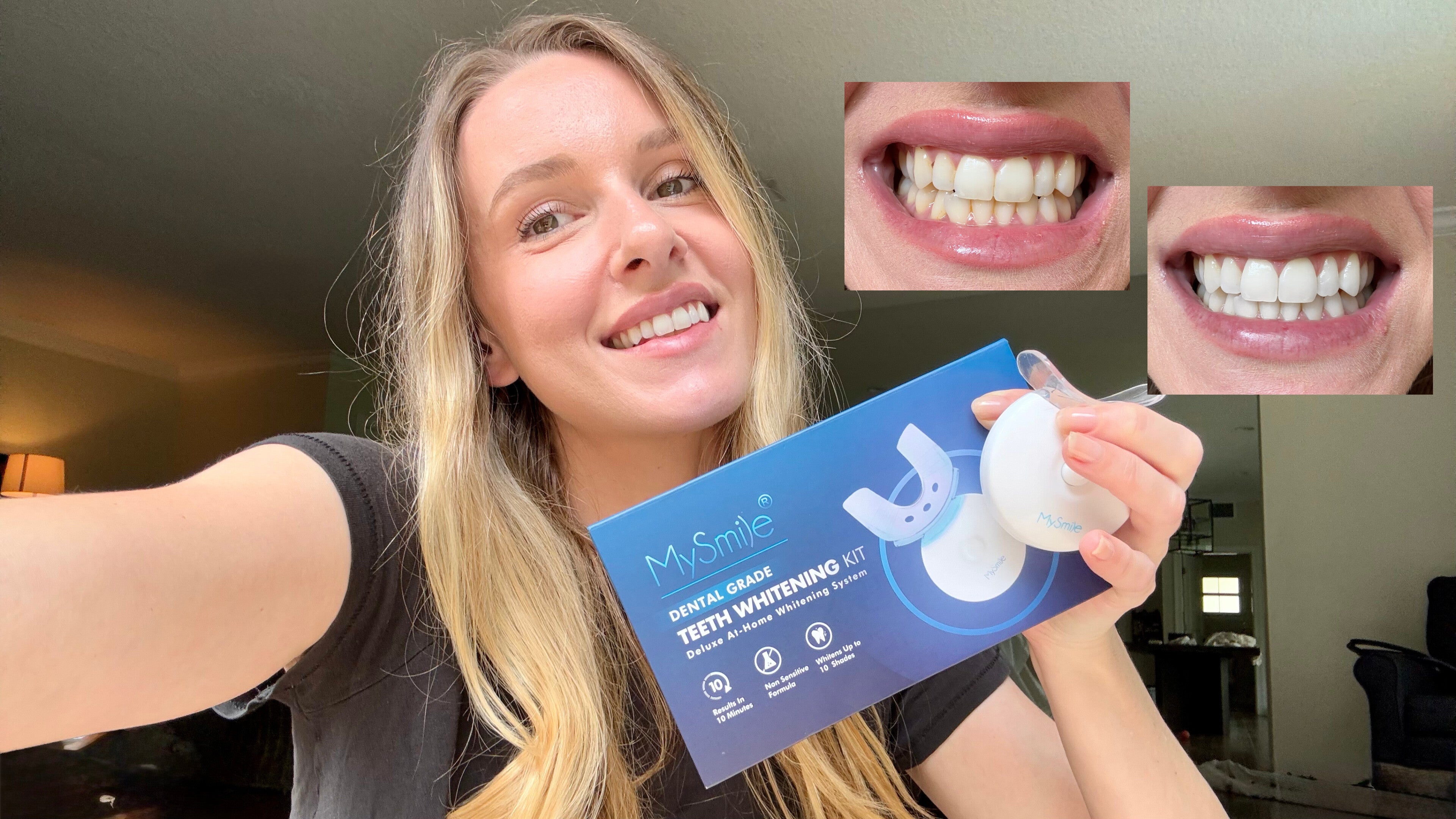 Blanqueador Dental My Smile