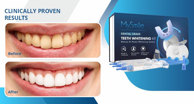 Blanqueador Dental My Smile